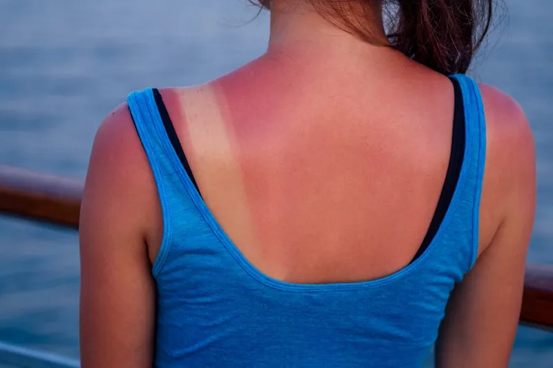 Vanliga symtom på solfrossa